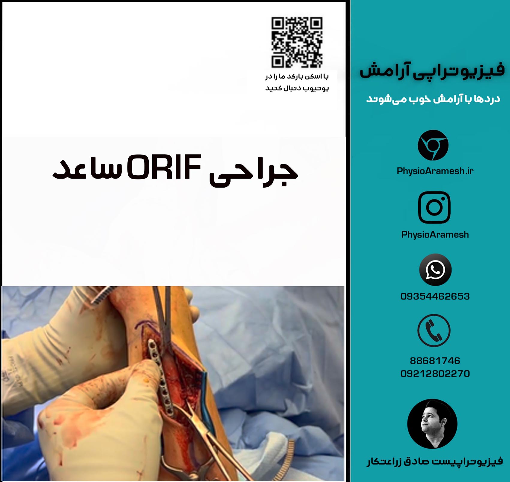 جراحی ORIF ساعد